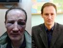 В Одесі побили історика, який доводив, що місту Одеса 600 років